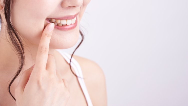 セルフホワイトニング